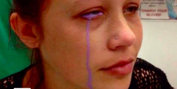 tattoo Model awaits surgery after eyeball tattoo goes extremely wrong