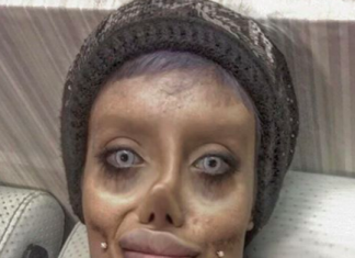 Teen dubbed Corpse Bride reportedly had 50 surgeries to look like Angelina Jolie
