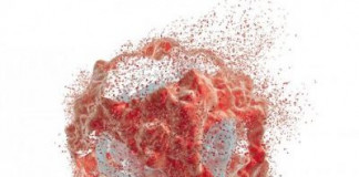 Nigeria records 102,000 new cases of cancer annually –NGO