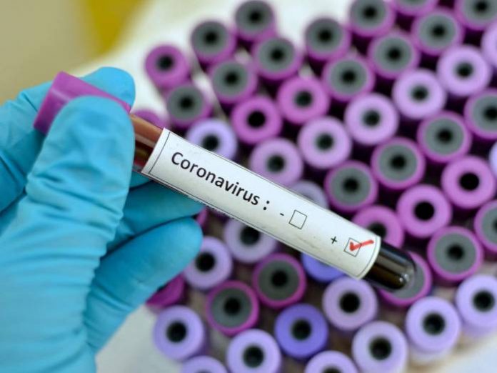 coronavirus getty Coronavirus: NCDC Explains Symptoms, Treatment, Advices On Protective Measures
