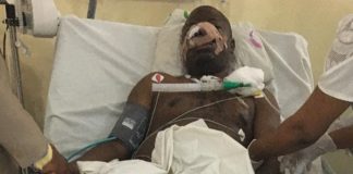 Wife Cuts Off Husband’s Tongue, Nose