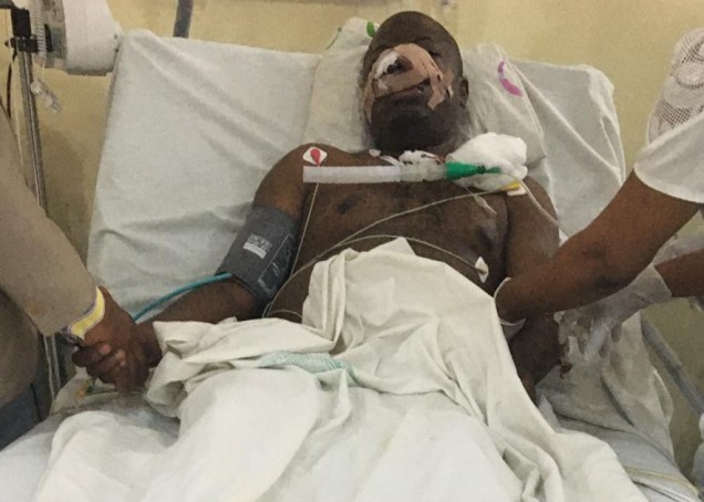 wife cuts-off huband nose Wife Cuts Off Husband’s Tongue, Nose