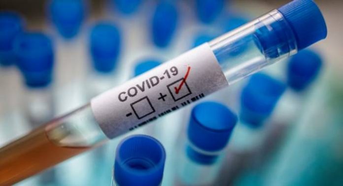 COVID-19 COVID-19: Medical Doctor Tests Positive In Osun