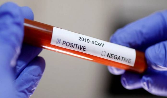 COVID-19-TEST-RESULT-727x430 Four-month-old Baby Tests Positive For Coronavirus in Kaduna