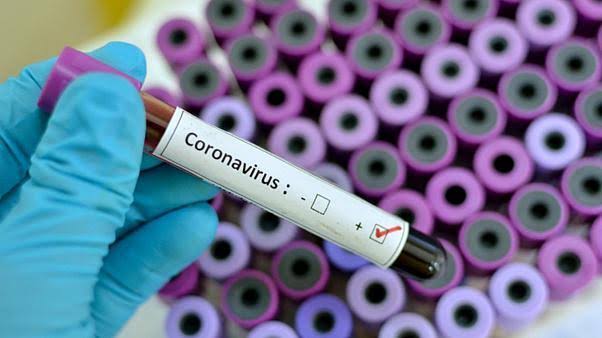 Nigeria Records 416 New Cases Of Coronavirus