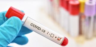 664 New COVID-19 Infections Confirmed In Nigeria