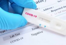NCDC Confirms 296 Additional Cases Of COVID-19