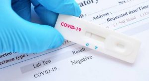NCDC Confirms 296 Additional Cases Of COVID-19