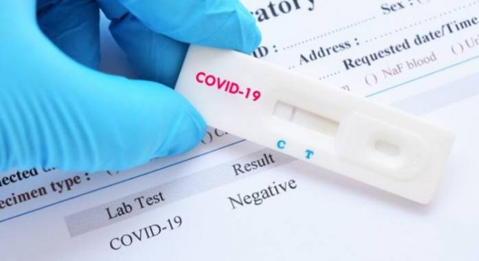 Covid-19 test NCDC Confirms 296 Additional Cases Of COVID-19