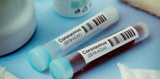 France: Virus Cases Spike To 4,700 In A Day