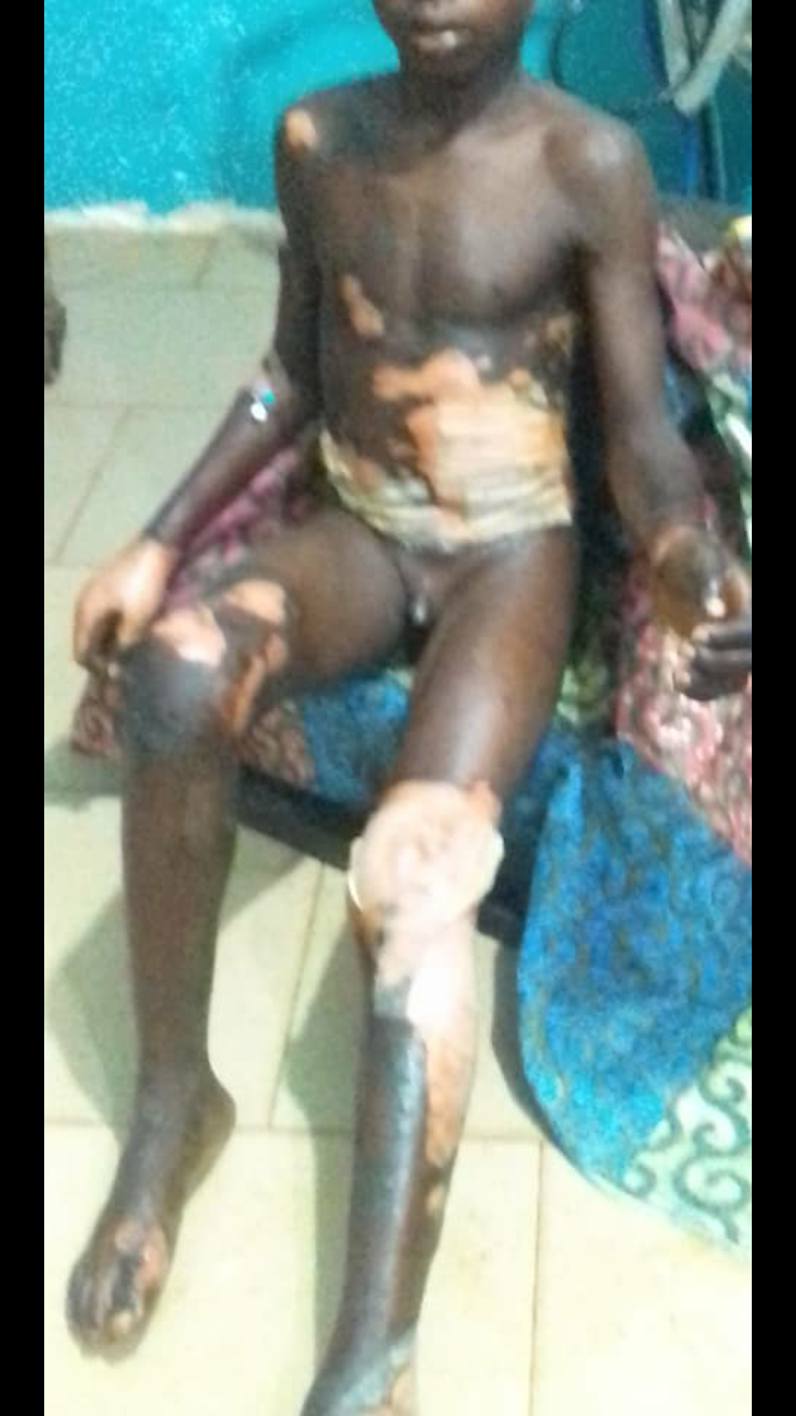 Boy, 13, Tied, Roasted For Stealing Rice In Ebonyi