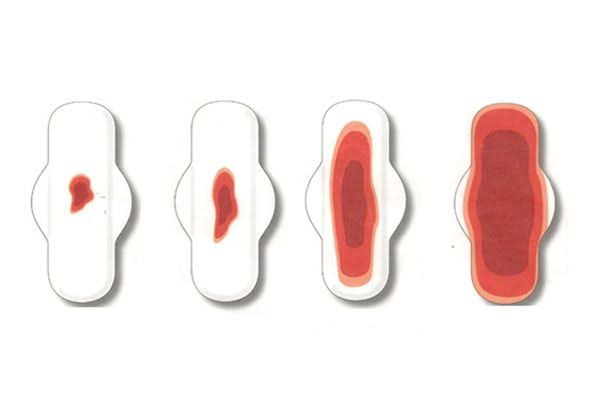 Heavy Menstruation, Major complaint In People With Fibroids- Gynaecologist