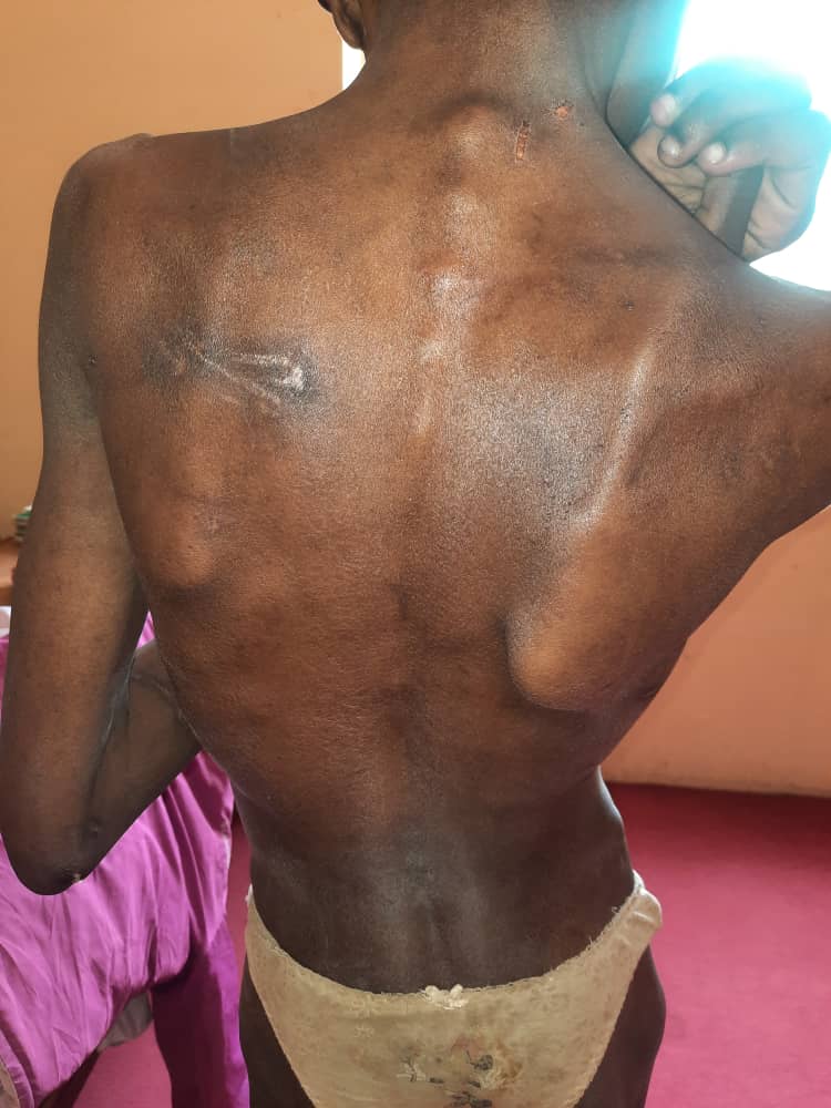 Police Rescue Caged, Malnourished 17-Year-Old Girl In Jos