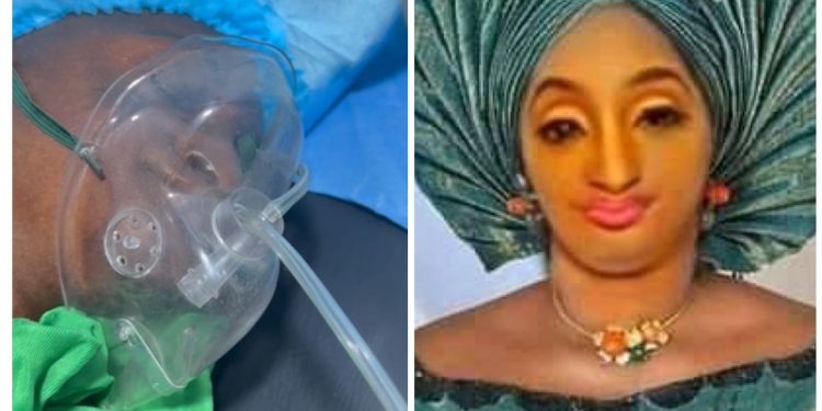 Social Media Actress, Aunty Ramota Allegedly In Coma After “Failed BBL”